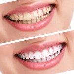 Learn More About Dental Implants In Gurnee and How They Can Restore Your Smile