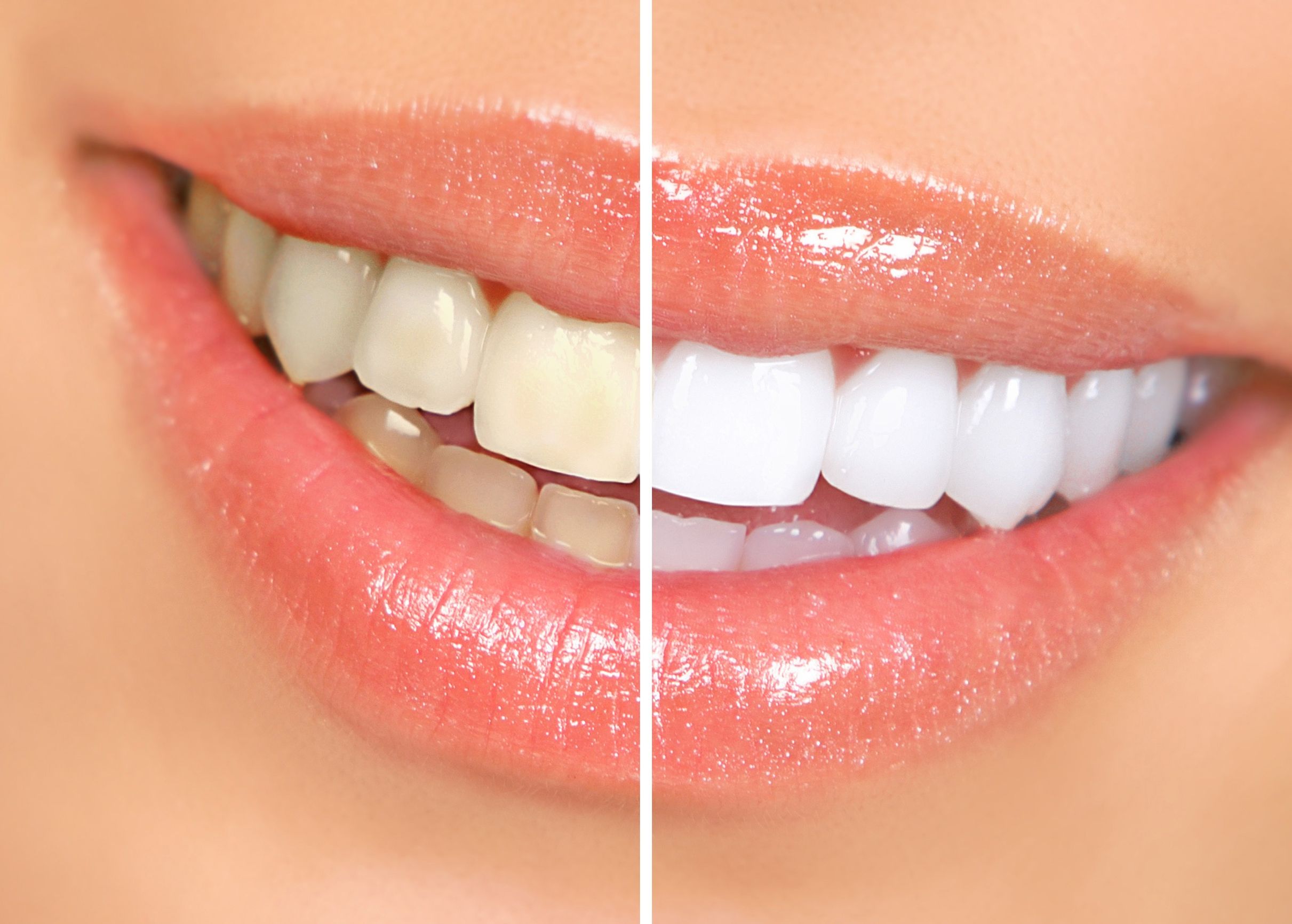 There Is A Cosmetic Dentist Keizer OR Patients Trust With Their Smile