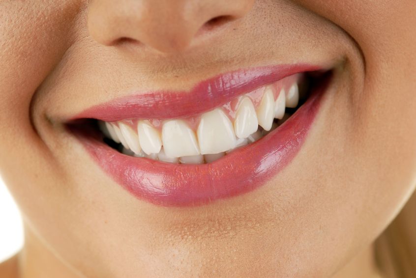 Your Smile Will Be Made Beautiful With Cosmetic Dental Care in Fishers, IN