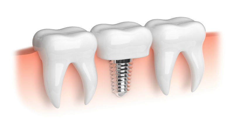 Advanced Services a Dentist in Macon, GA Can Help You With