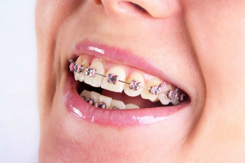 What Are Some Examples of the Services Provided by an Orthodontist?